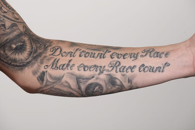 Redding asked the doctor not to operate over his tattoo